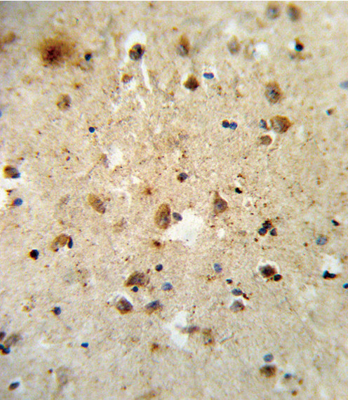 ATF6 Antibody in Immunohistochemistry (Paraffin) (IHC (P))