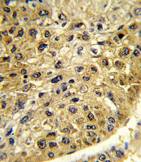 DCT Antibody in Immunohistochemistry (Paraffin) (IHC (P))