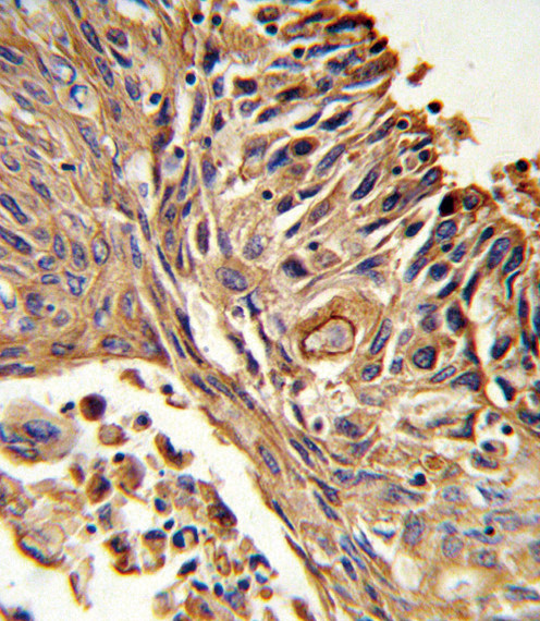 IL18RAP Antibody in Immunohistochemistry (Paraffin) (IHC (P))