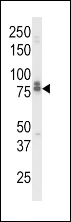 IL18RAP Antibody in Western Blot (WB)