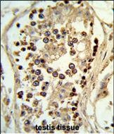 ABHD12 Antibody in Immunohistochemistry (Paraffin) (IHC (P))