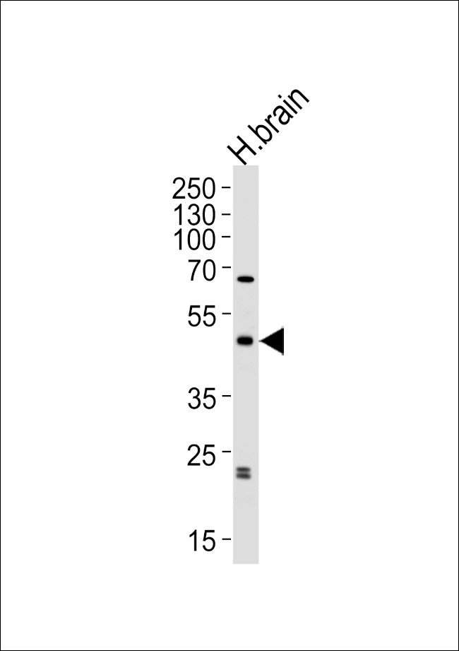 ABHD12 Antibody in Western Blot (WB)