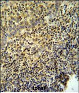 WASP Antibody in Immunohistochemistry (Paraffin) (IHC (P))