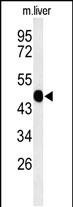 WASP Antibody in Western Blot (WB)