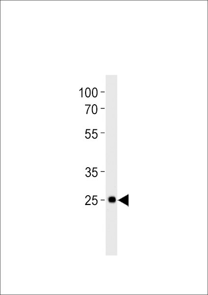 DLX6A Antibody in Western Blot (WB)