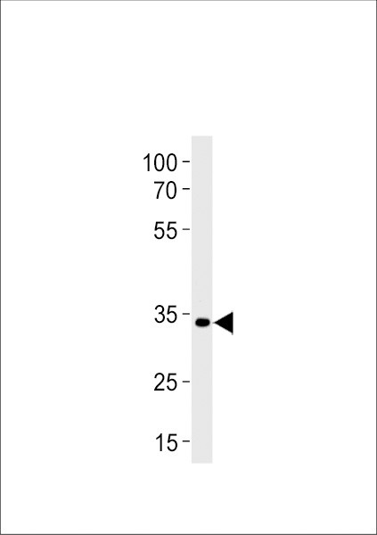 PAX2A Antibody in Western Blot (WB)