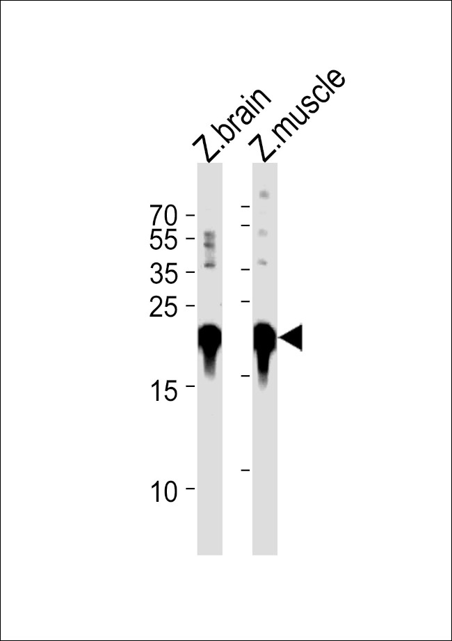 DJ-1 Antibody in Western Blot (WB)