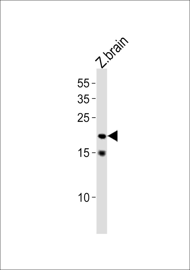 TCF21 Antibody in Western Blot (WB)