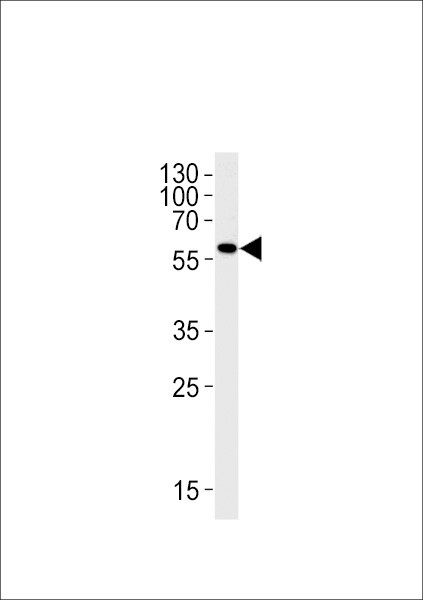 MAO Antibody in Western Blot (WB)