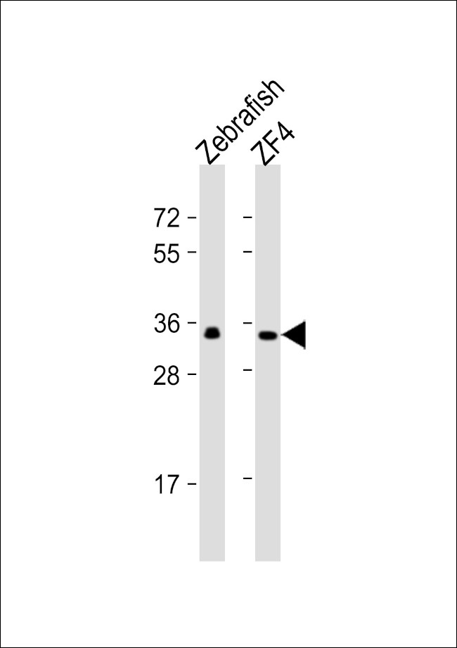 GNB1 Antibody in Western Blot (WB)