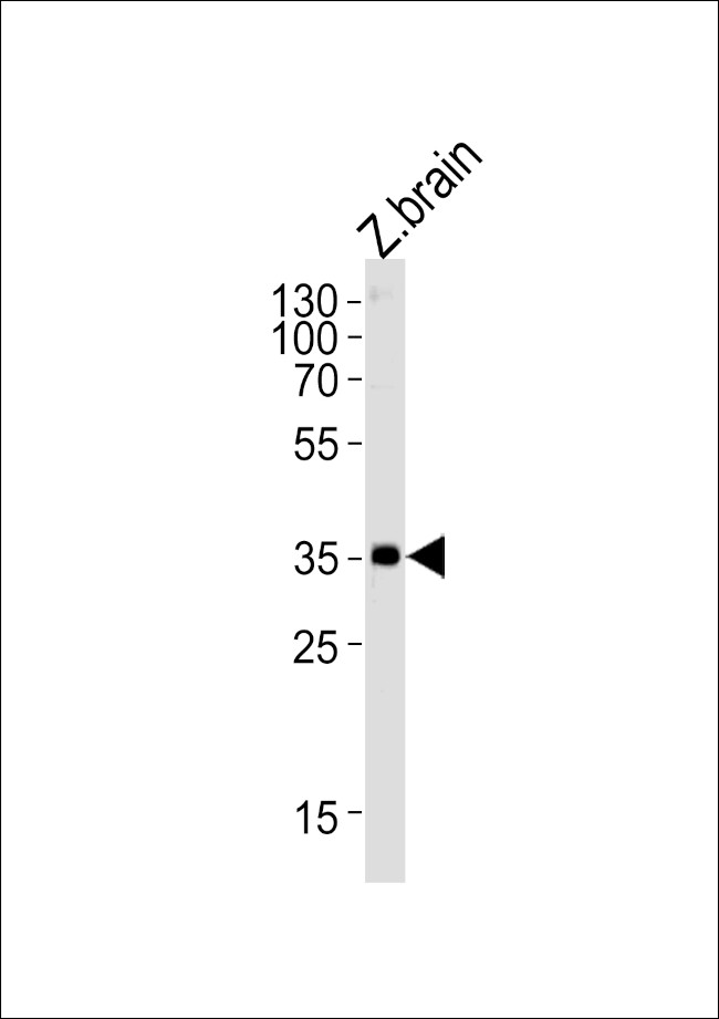 GNB1 Antibody in Western Blot (WB)