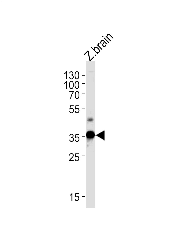 GNB1 Antibody in Western Blot (WB)