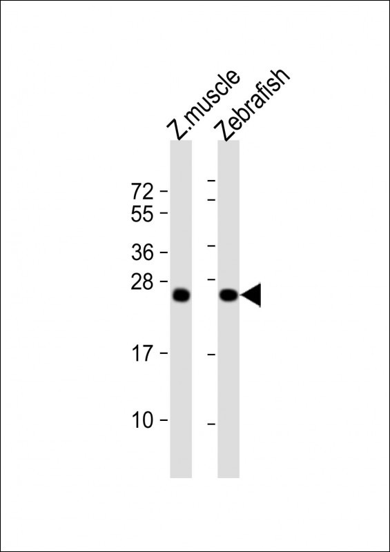 DUSP22A Antibody in Western Blot (WB)