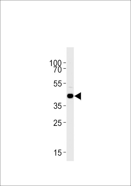 S1P1 Antibody in Western Blot (WB)