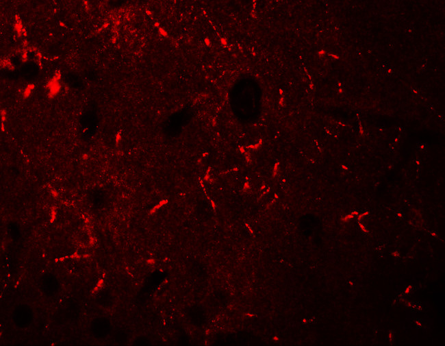 KCNK12 Antibody in Immunohistochemistry (Paraffin) (IHC (P))