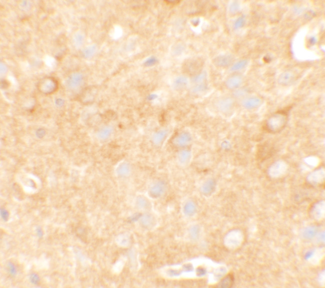 KCNK12 Antibody in Immunohistochemistry (Paraffin) (IHC (P))