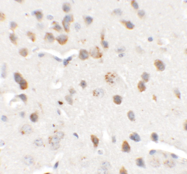 CHD7 Antibody in Immunohistochemistry (Paraffin) (IHC (P))