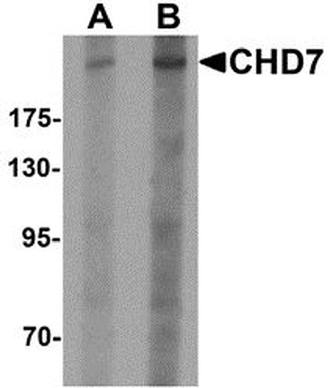 CHD7 Antibody in Western Blot (WB)