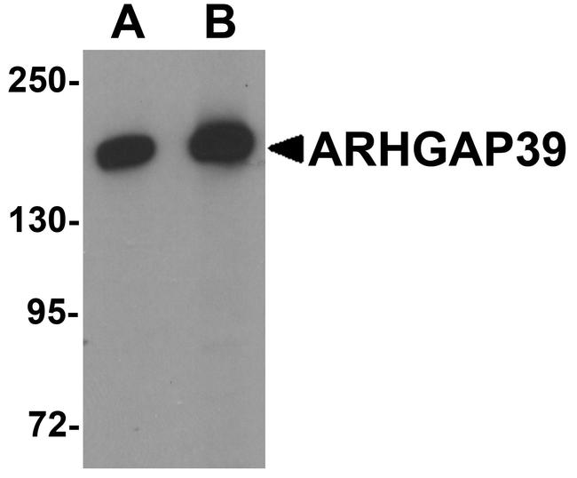 KIAA1688 Antibody in Western Blot (WB)