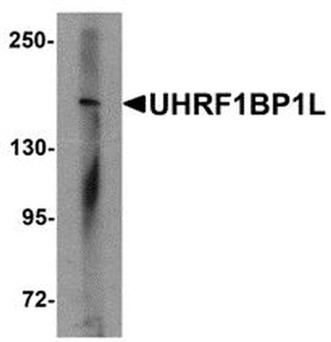 KIAA0701 Antibody in Western Blot (WB)