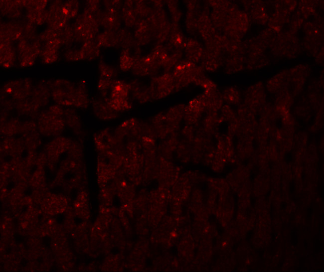 DDA1 Antibody in Immunohistochemistry (Paraffin) (IHC (P))