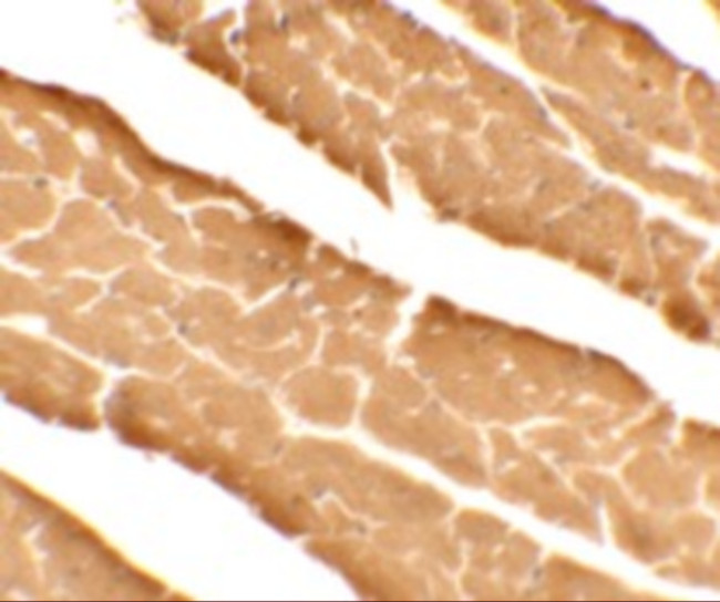 DDA1 Antibody in Immunohistochemistry (Paraffin) (IHC (P))