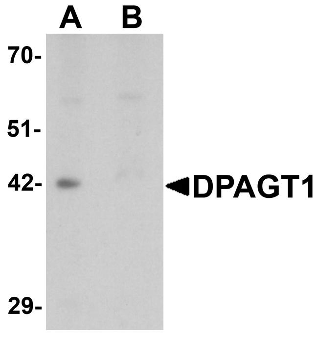 DPAGT1 Antibody in Western Blot (WB)