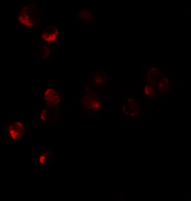 HIGD1A Antibody in Immunocytochemistry (ICC/IF)