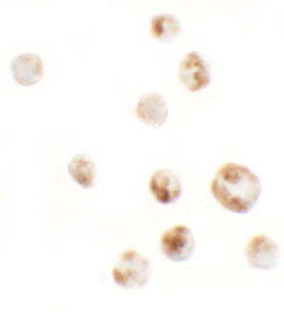 AFAP1L1 Antibody in Immunocytochemistry (ICC/IF)