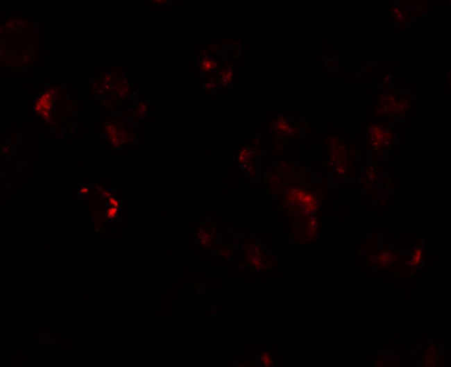 AFAP1L1 Antibody in Immunocytochemistry (ICC/IF)