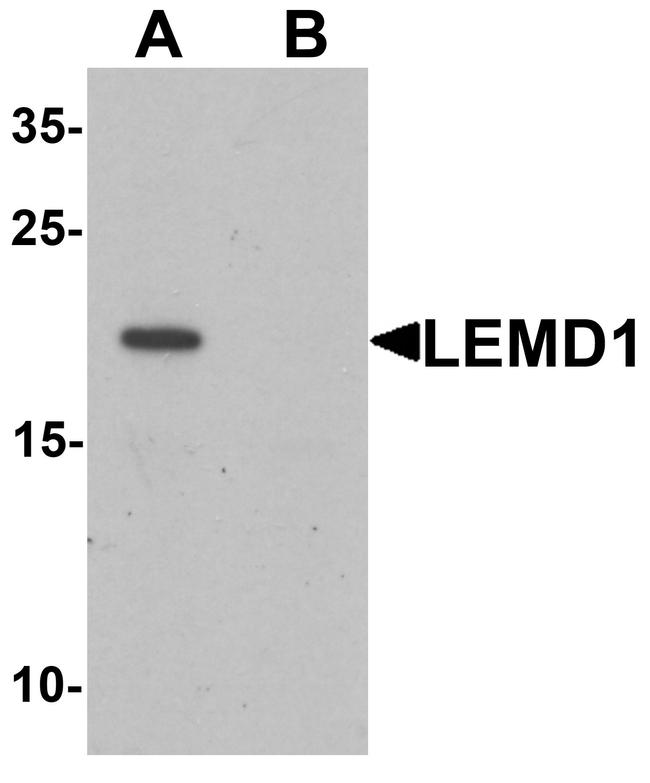 LEMD1 Antibody in Western Blot (WB)