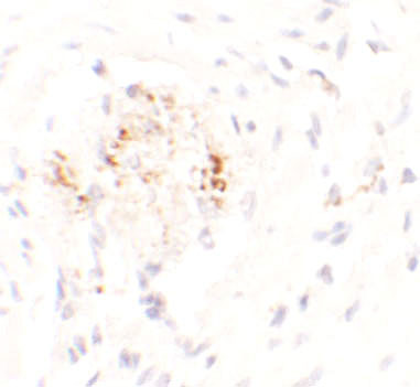 MAN1 Antibody in Immunohistochemistry (Paraffin) (IHC (P))