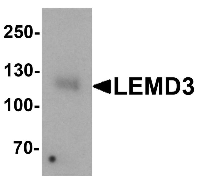 MAN1 Antibody in Western Blot (WB)