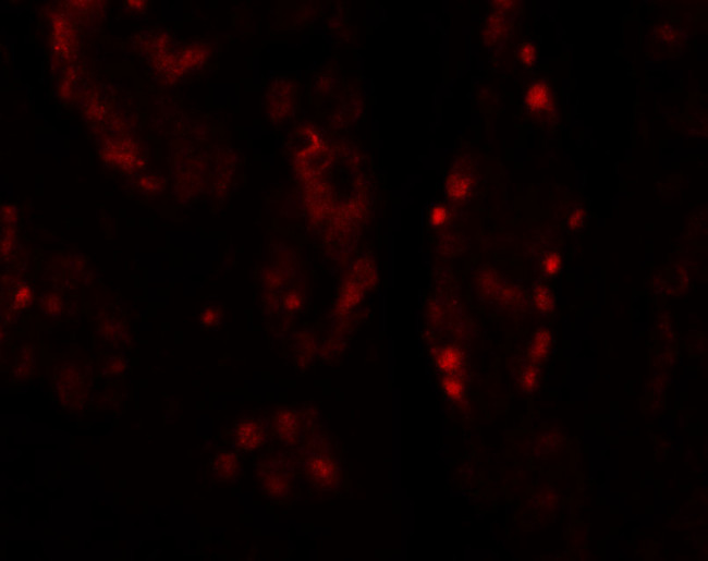 DISP1 Antibody in Immunohistochemistry (Paraffin) (IHC (P))