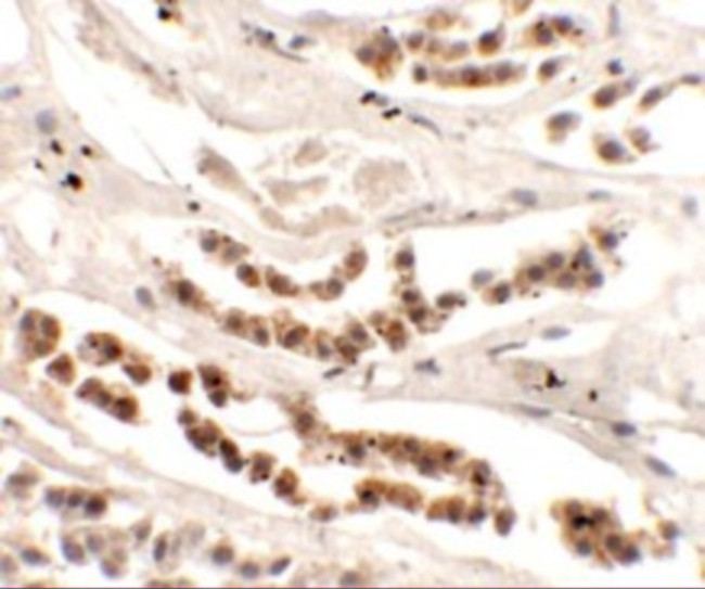 DISP1 Antibody in Immunohistochemistry (Paraffin) (IHC (P))