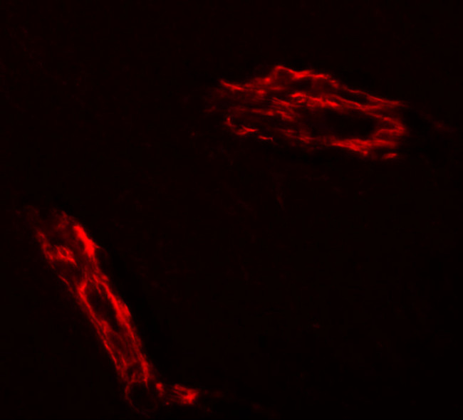 RAPGEF3 Antibody in Immunohistochemistry (Paraffin) (IHC (P))