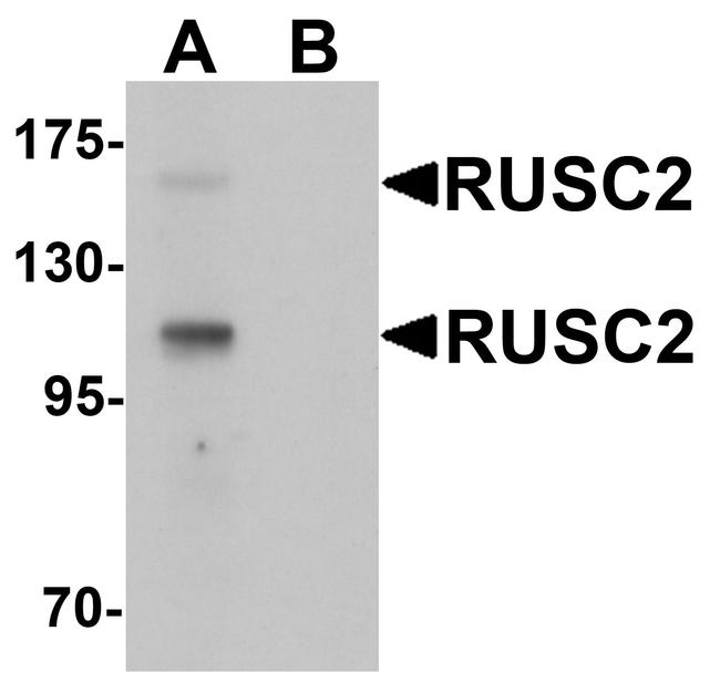 RUSC2 Antibody in Western Blot (WB)