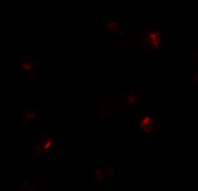 B9D1 Antibody in Immunocytochemistry (ICC/IF)