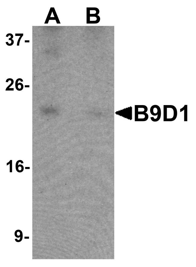 B9D1 Antibody in Western Blot (WB)