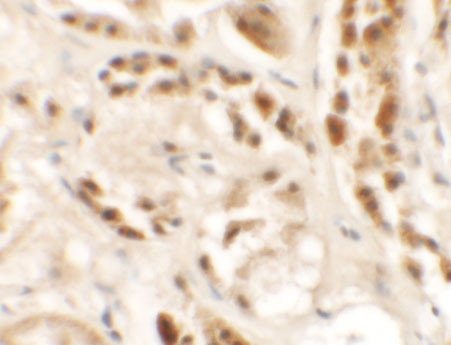 SIGLEC15 Antibody in Immunohistochemistry (Paraffin) (IHC (P))