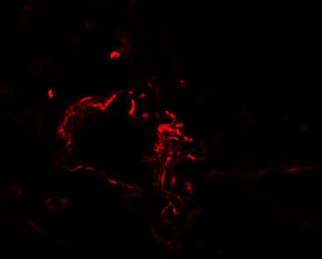 ACSL1 Antibody in Immunohistochemistry (IHC)