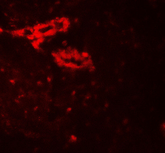 IL1F9 Antibody in Immunohistochemistry (Paraffin) (IHC (P))