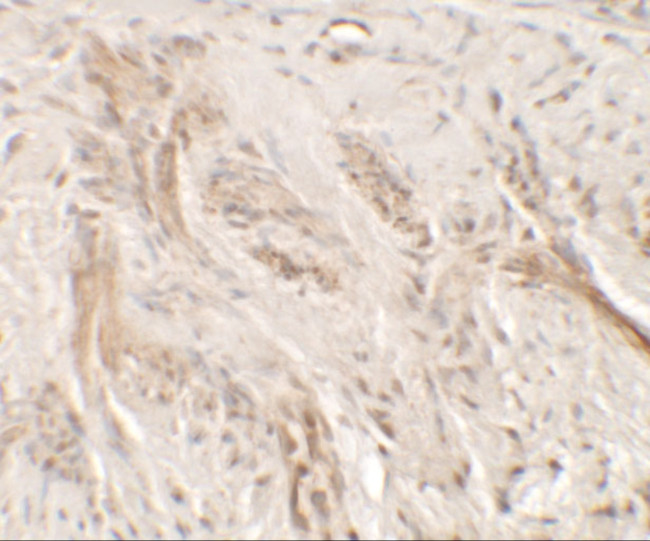 IL1F9 Antibody in Immunohistochemistry (Paraffin) (IHC (P))