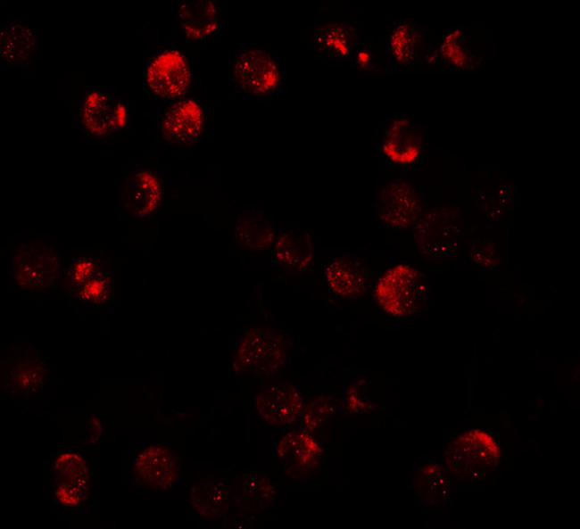 DNM1L Antibody in Immunocytochemistry (ICC/IF)