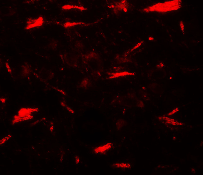 LAMTOR3 Antibody in Immunohistochemistry (Paraffin) (IHC (P))