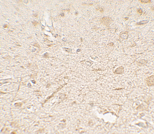 LAMTOR3 Antibody in Immunohistochemistry (Paraffin) (IHC (P))