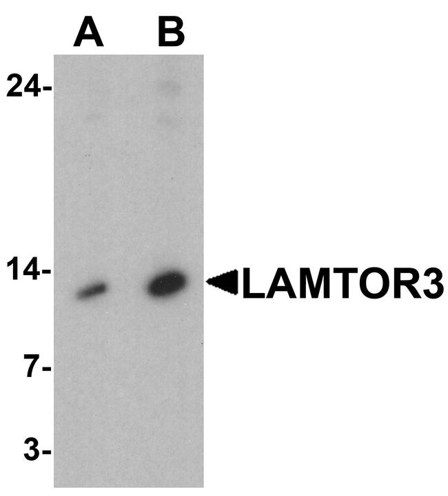 LAMTOR3 Antibody in Western Blot (WB)