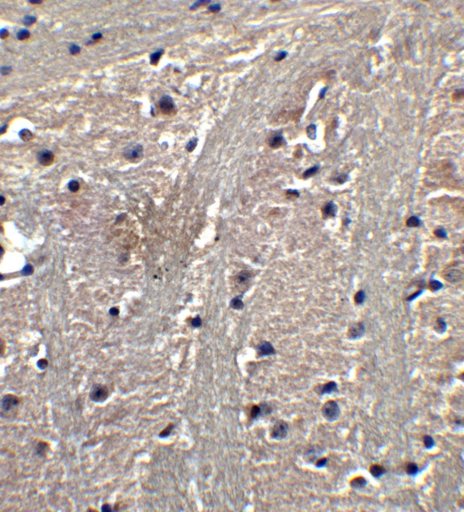 TET1 Antibody in Immunocytochemistry (ICC/IF)