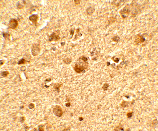 TET1 Antibody in Immunohistochemistry (Paraffin) (IHC (P))