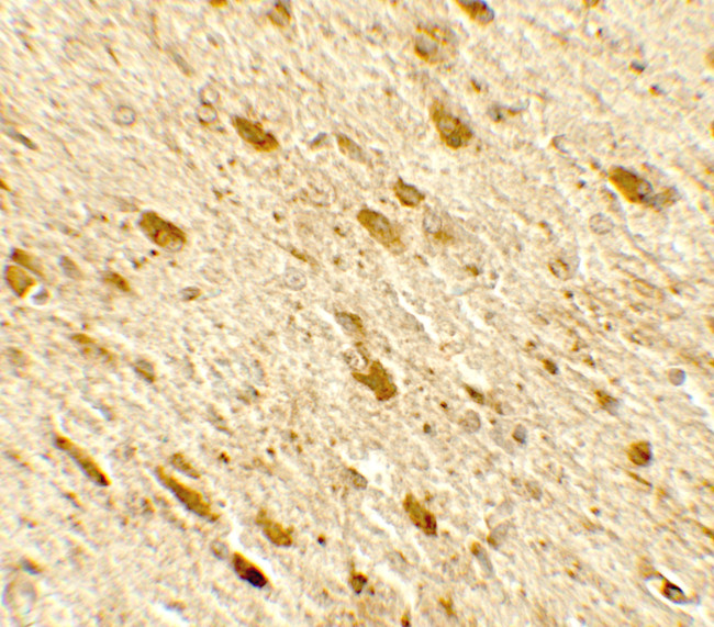 DENR Antibody in Immunohistochemistry (Paraffin) (IHC (P))